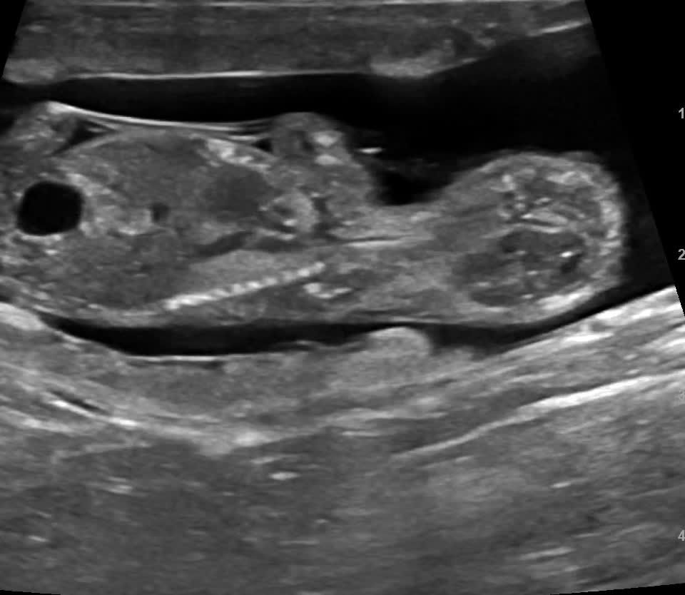 Ultrasound video of a single puppy curled up